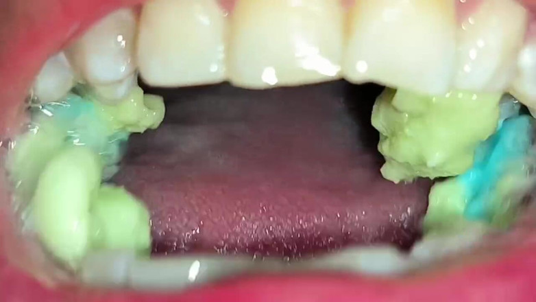 Isabel: Snake Gum