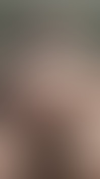 Sls-frank Jerks off My Split Cock with Subincision