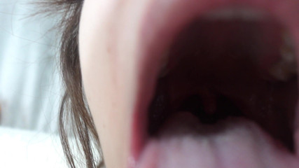 AmayaMori: Chị kế Ấn Độ của tôi cho tôi xem bên trong miệng...