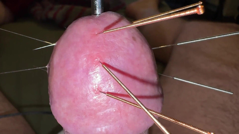 Qualzucht: Acupuncture - Orgasm!