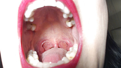 Abby Anna: Velká doširoka otevřená ústa