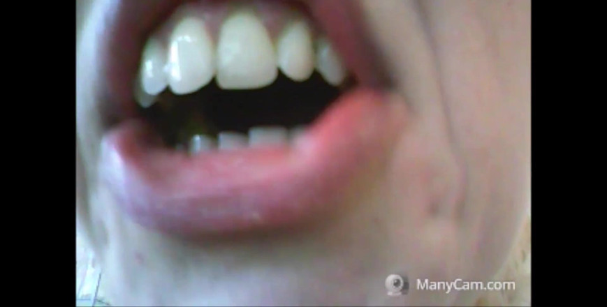 savannahamatoriale: I denti di chantal cadono a pezzi, marcio e nero