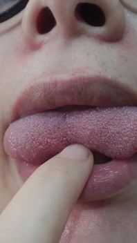 我的继妹玩舌头恋物癖，玩弄她的嘴巴，然后露出她的牙齿