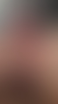 My Tight Uncut Phimosis Cock Stretched