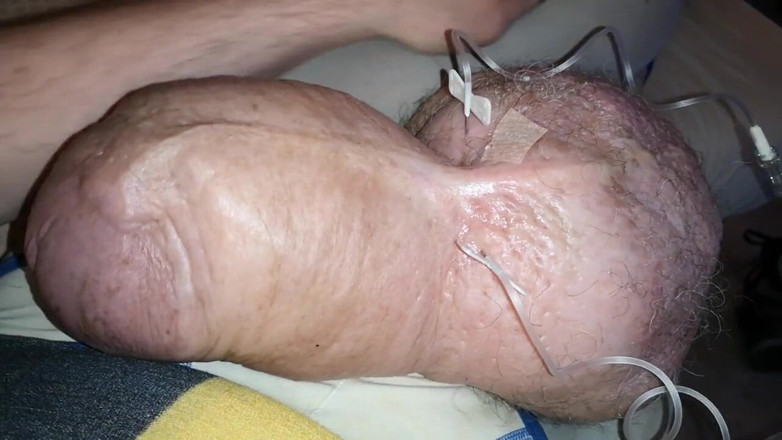 Monster_Meat_: 私の二重注射の2リットルのブドウ糖「中途半端」