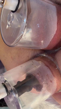 Extrême, gros plan, double pompe sous vide, cul et chatte