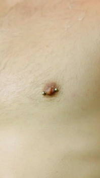Orman esareti