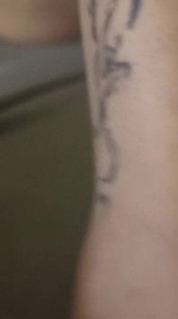 Overview of My Body