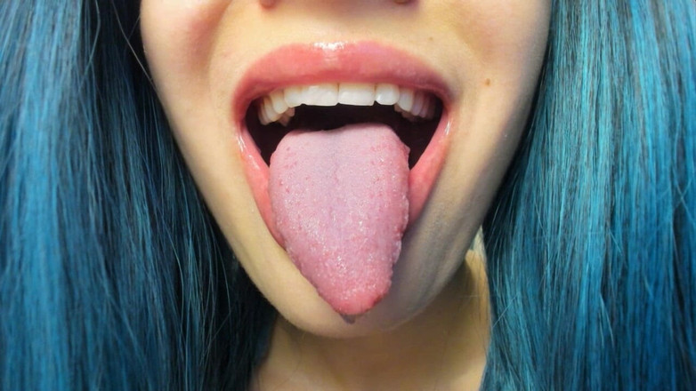 Rarible Diamond: Sbavando gocciolante dalla mia lingua