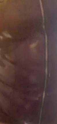 Masturbation