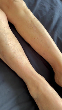 Bare Feet and Legs
