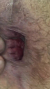 Anal Training