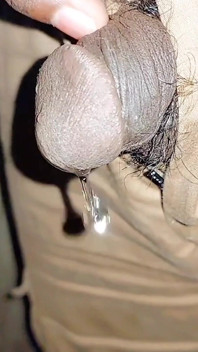 Mikro penis işeme derlemesi