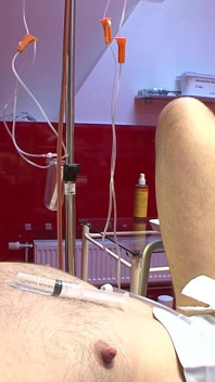 BDSM Domina 와 그녀의 남자 노예 파열 공과 페깅