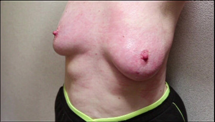 Bouncy Tits Action: スローモーションフルで乳首鞭打ち