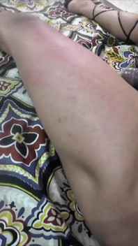 Spanking