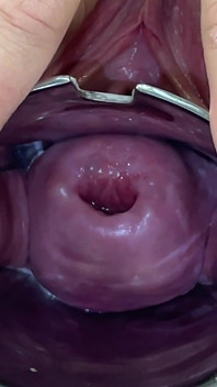 Glass Dildo Cervix Penetration