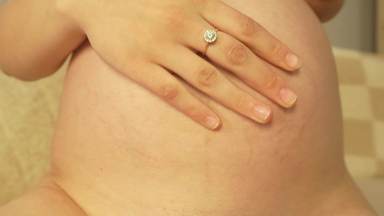 AmayaMori: Pregnant Stepsister Shows off Her Belly and Stretch Marks Then...