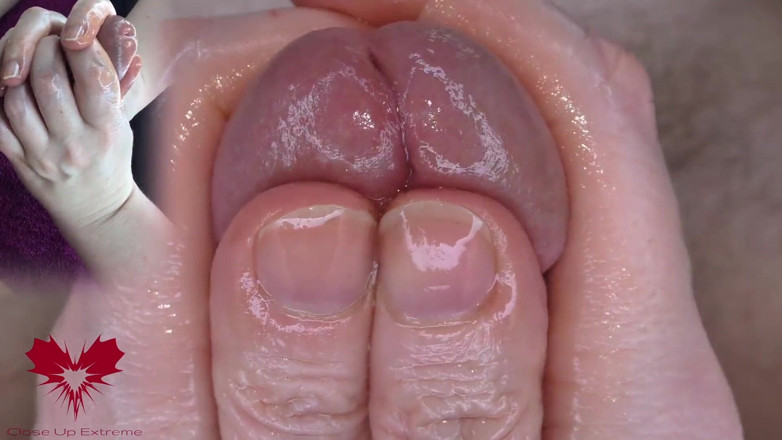 Close Up Extreme: Super Close-up of the Glans. Urethral Games with the Dilator.