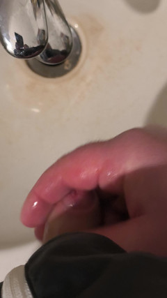 Uglydick: Wixx moche dans la réserve