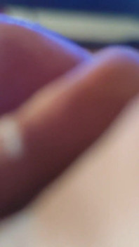 Podivný hrbolatý penis s obrovskou hlavou.