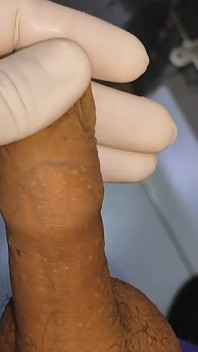 In a Doctor's Office I Apply Hot Glue to My Dick.
