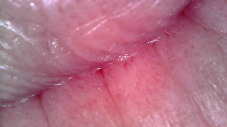 Nicoletta Embassi: Medical Endoscope Oral Exam: Gummy Chewing, Extreme Teeth &amp; Tongue Macro