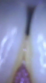 Tief in Sydneys Mund - Sydney Screams zeigt mund, zunge, Hals und Uvula mit Endoskopische