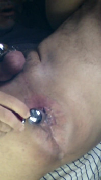Fire Inside My Ass
