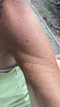 Horny in the Woods. What Do You Think Happens?