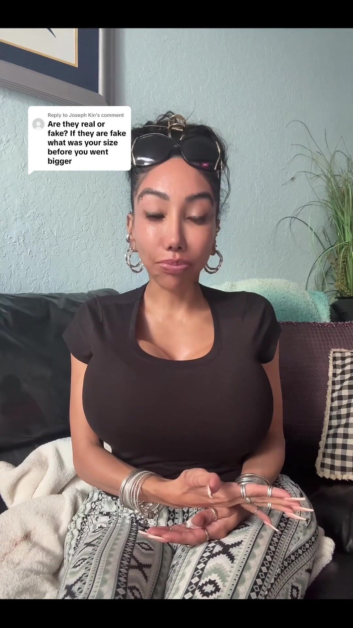 Anakaliyah: Just Wanna Share Some of My Plastic Surgery