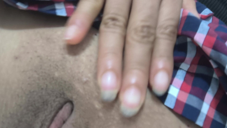 NEGRITA SEXY: Ma coś nienormalnego w pochwie !! Dziwna grudka na jej wargach...