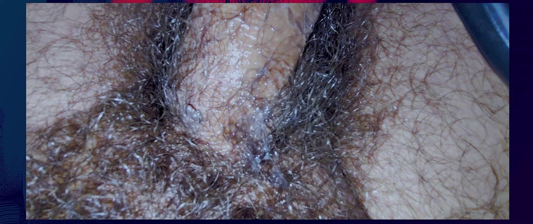 Stink HairyMale: Maska - Stopy i Buty