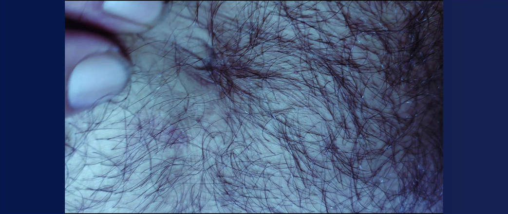 Stink HairyMale: Burtă, subraț și penis