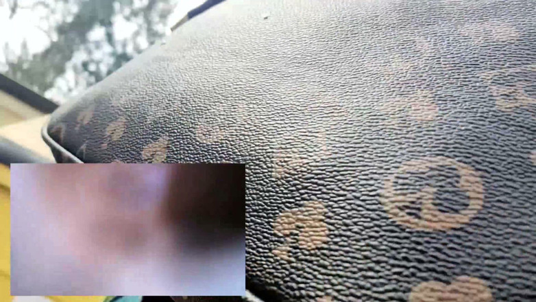 Nicoletta Embassi: O Cameră Cu Pastilă În Timp Ce Merg: În Stomacul Meu, Vedere...