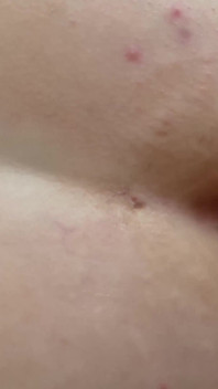 Student Does Dirty Ass-to-mouth and accidental Anal Creampie, Anally Prolapses