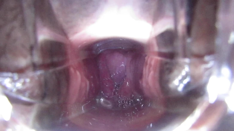 VeeVee Vixen: Cum Cervix Insemination