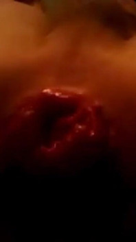 Il mio primo video di prolasso anale che ho girato