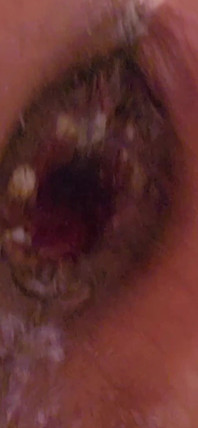 Huge Asspussy Gape with Help From 9.5 in. Circumference King Cock Chubby!