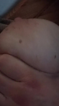 Brustmassage intensivo