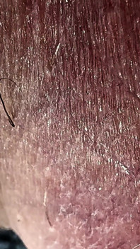 Massaggia le uova fino alla fine