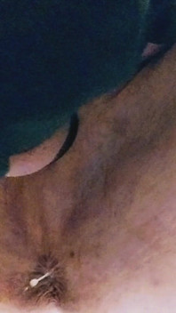 Park and Ride Breeding.