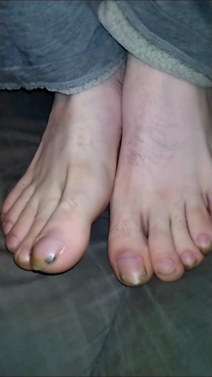 Au79: Fantasi del piede