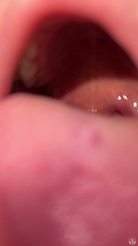 Mouth Fetish