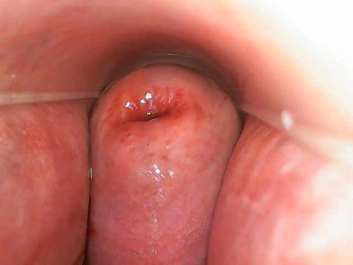 TripleXTransMan: Mein gebärmutterhals aus nächster nähe