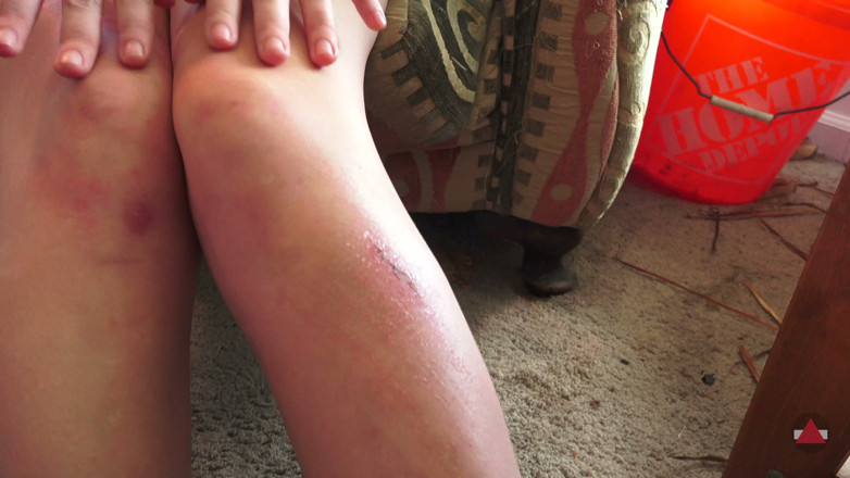 Grand D assjob: Sunny's Sexy Scars