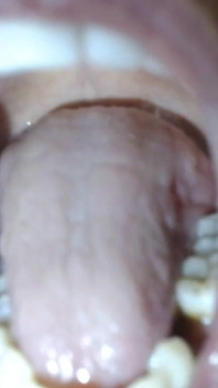 Super closeup bocejando e vista completa