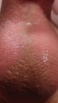 Sání a lízání koule pokryté macechou