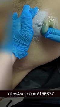 #56 Male Waxing