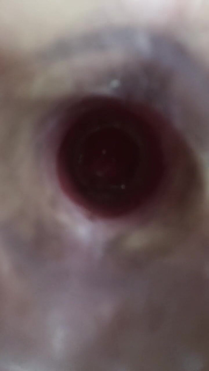 MiguellTrajano: Teď mám sexy zadek